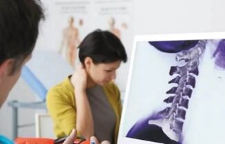 Léčba krční osteochondózy